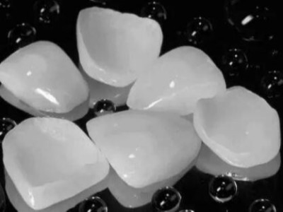 承德口腔解答：補(bǔ)牙的時候?yàn)槭裁匆パ?